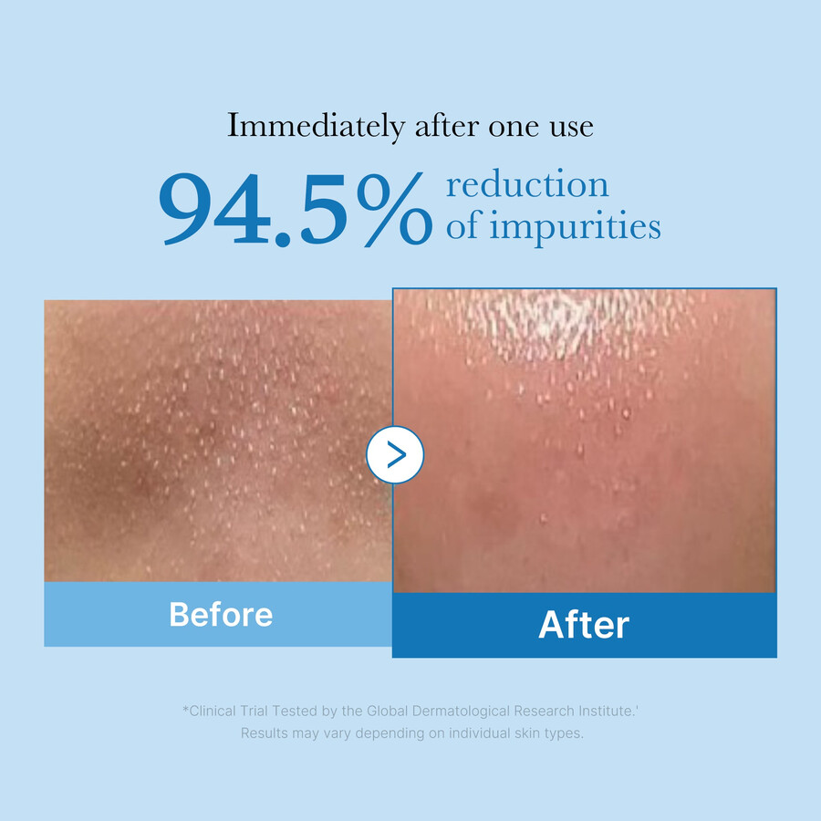 hloubkově čistící olej medicube zero pore blackhead