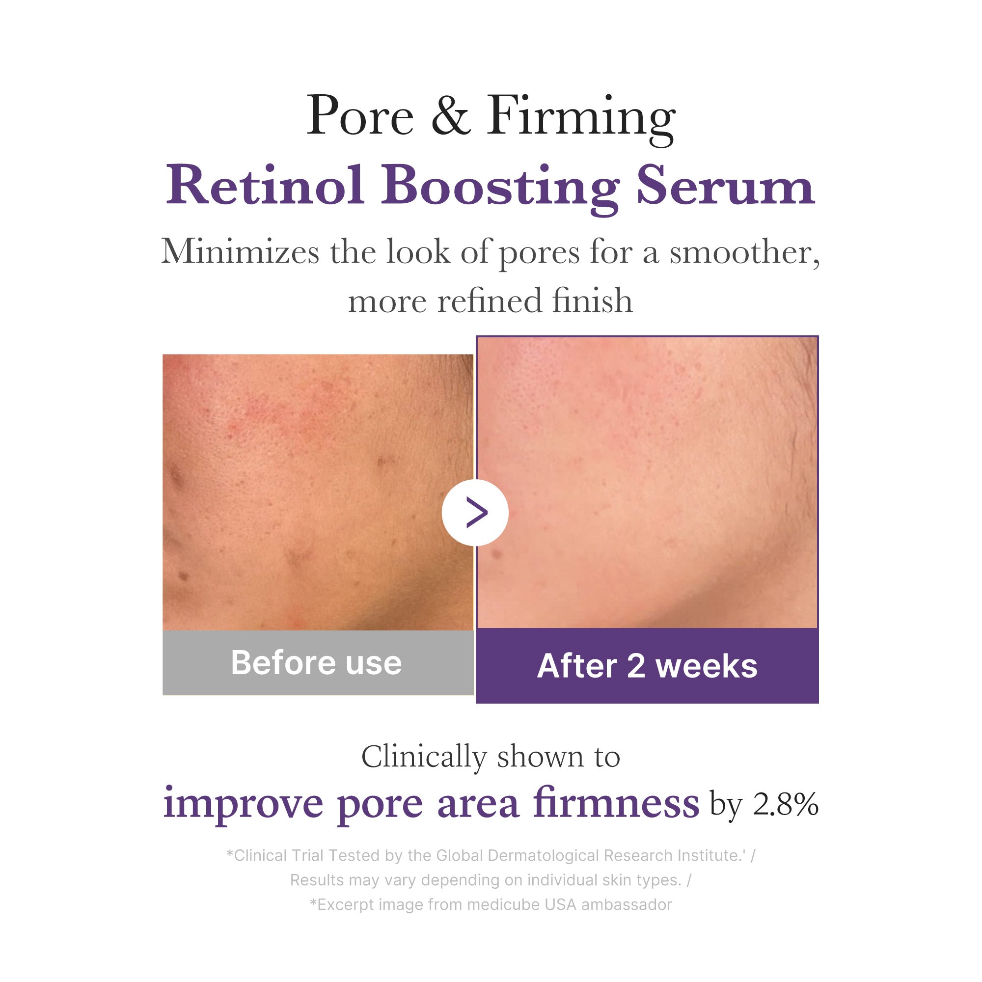 retinol nmn posilující sérum