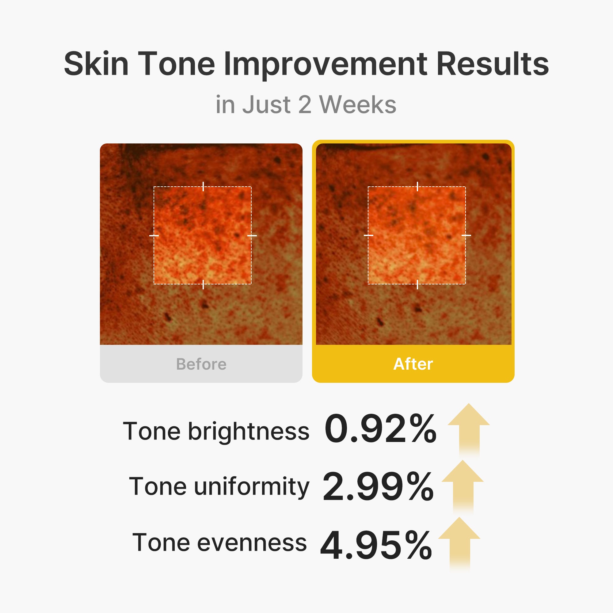 krém v kapslích kojic acid turmeric vita